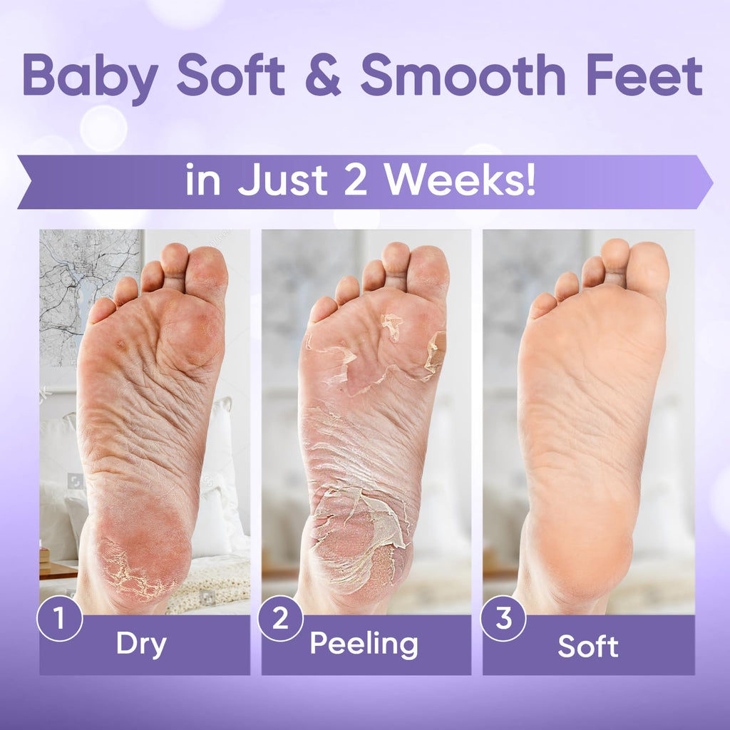 Foot Peeling Mask for Dry Cracked Feet | Foot Mask to Exfoliate Rough, Cracked, Dry Feet, Calluses for Soft Baby Feet Results | Made with Aloe Vera Extract for Women & Men (2 Pairs) | Lavender