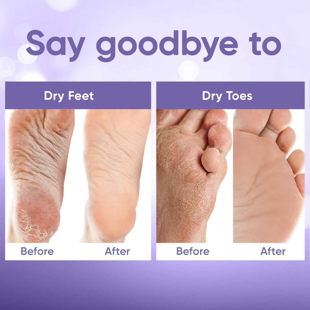 Foot Peeling Mask for Dry Cracked Feet | Foot Mask to Exfoliate Rough, Cracked, Dry Feet, Calluses for Soft Baby Feet Results | Made with Aloe Vera Extract for Women & Men (2 Pairs) | Lavender