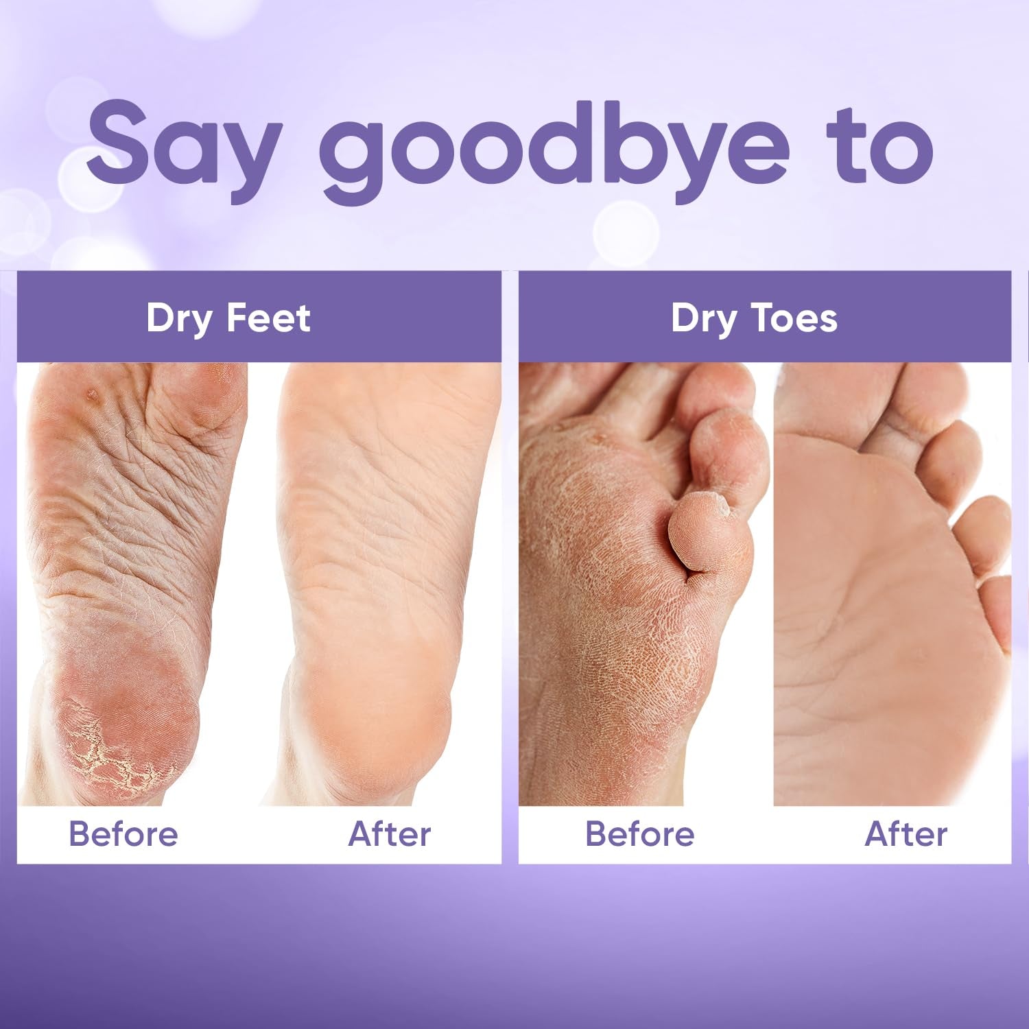 Foot Peeling Mask for Dry Cracked Feet | Foot Mask to Exfoliate Rough, Cracked, Dry Feet, Calluses for Soft Baby Feet Results | Made with Aloe Vera Extract for Women & Men (2 Pairs) | Lavender